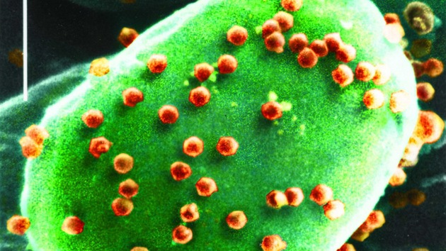 Hallan un virus nunca detectado en el organismo humano que afecta el cerebro