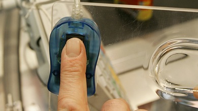 Empleados 'fantasma': médicos en Brasil usan dedos de silicona para fichar