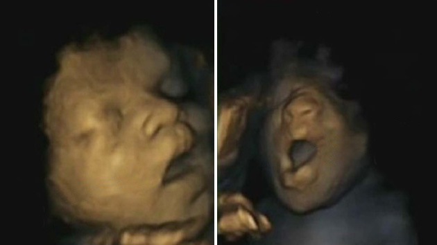 Foto: Los bebés aprenden a anticipar y coordinar sus gestos en el útero