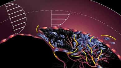 Descubren el enigma de las metástasis