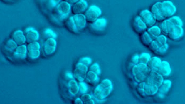 Microbios generadores de metano, culpables de la mayor extinción en la Tierra