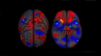 Confirman que el cerebro de los hombres es mayor que el de las mujeres