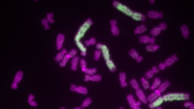 Resuelven el misterio del ADN 'Frankenstein' culpable del cáncer
