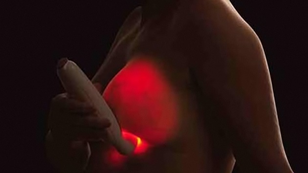Gran Bretaña denuncia una campaña "engañosa" de detectores de cáncer de mama