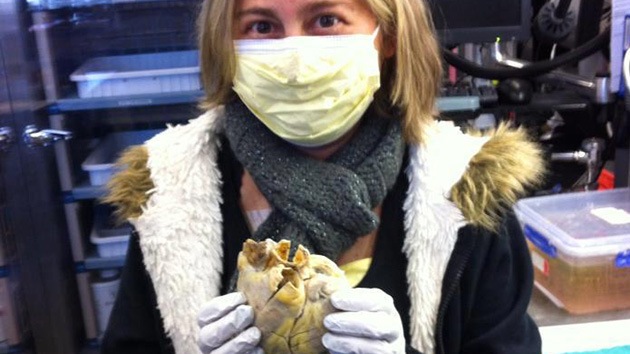 La foto de una mujer trasplantada 'con el corazón en la mano' conmueve la Red