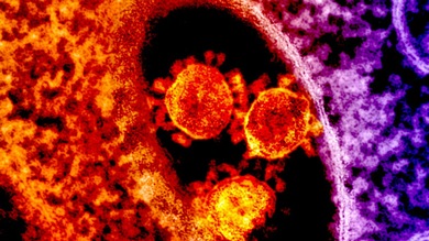 Descubren que media humanidad porta un virus desconocido hasta ahora