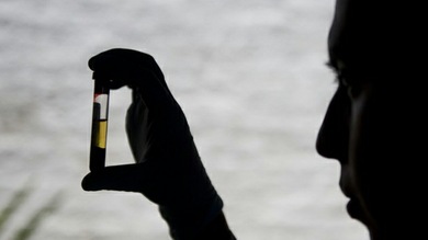 Una vacuna contra la malaria, creada en laboratorios australianos