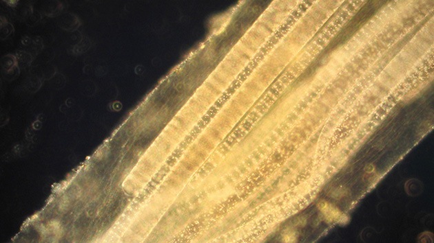 'Pescan' en las costas de Chile un nuevo microbio útil para el tratamiento del cáncer