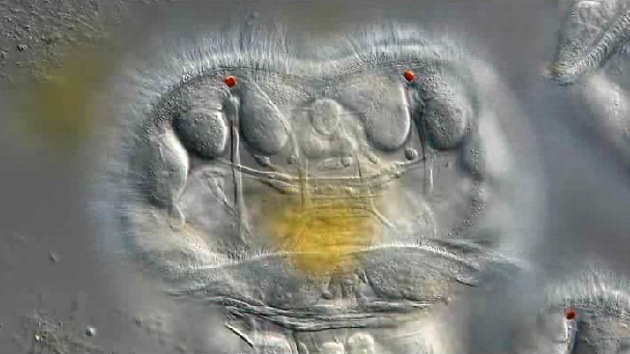El video de una 'merienda' de invertebrados gana el concurso de fotografía microscópica