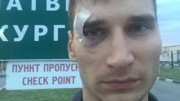 Oppositioneller russischer Journalist von Donezker Volksmilizen festgenommen, geschlagen und deportiert