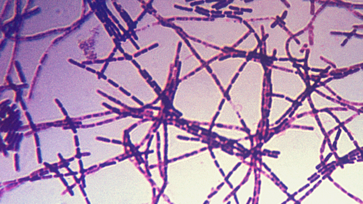"Unverbrüchliche Freundschaft" - Neue US-Wirtschaftsspionage, Cyberangriffe und Anthrax-Experimente auf deutschem Boden