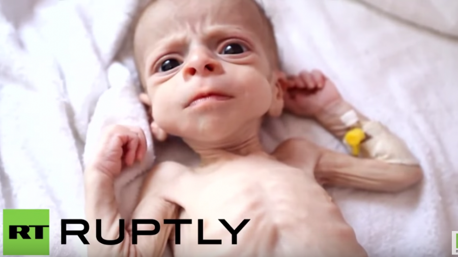 Militärintervention von Saudi Arabien im Jemen bedroht das Leben von 10 Millionen Kindern