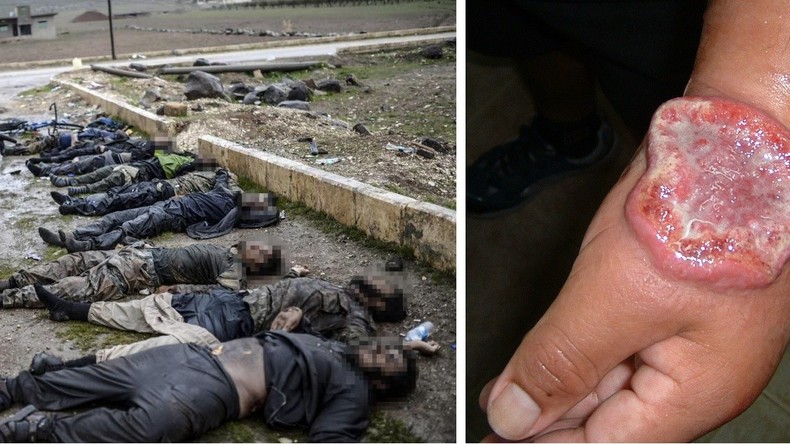 Tödliche Spur des IS: Fleischfressende Krankheit breitet sich in Syrien aus