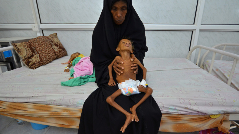 Hilfsorganisationen schlagen Alarm: Über 1 Million Kinder im Jemen von Hunger und Cholera betroffen