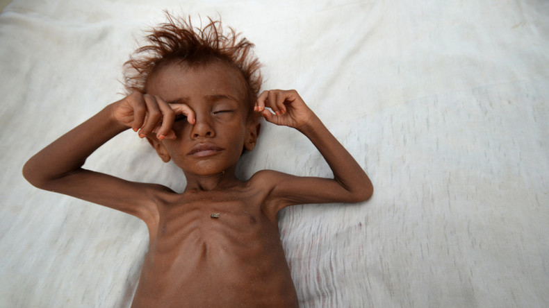 Jemen: Über 50.000 Kinder werden bis Ende des Jahres an Folge der Saudi-Intervention sterben