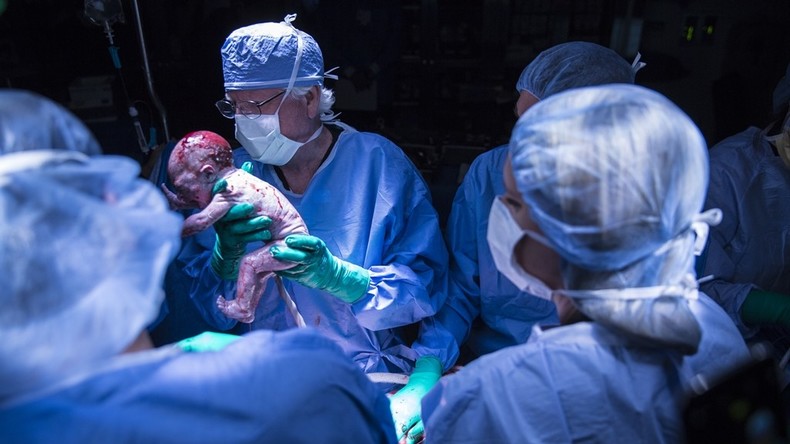 US-Bürgerin bekommt Baby nach Gebärmutter-Transplantation