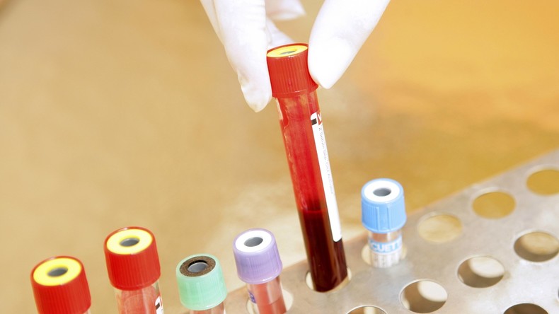 Bio-Kurs enthüllt Affäre: Blutgruppentest hilft Studentin ihren biologischen Vater zu finden