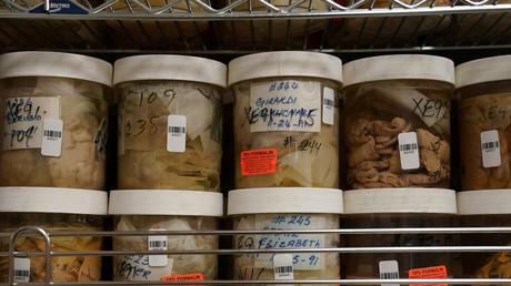 "Schlimmer als der Tod": Wiederbelebter Schweinekopf schürt Ängste vor menschlicher Reanimation