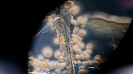 Studie: Immer mehr multiresistente Keime in europäischen Krankenhäusern