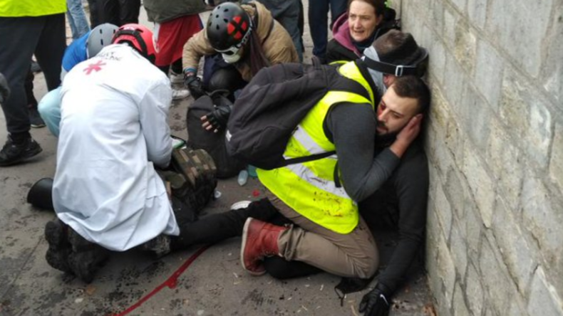 Schockierende Szenen: Blendgranate reißt einem Demonstranten in Paris die Hand ab