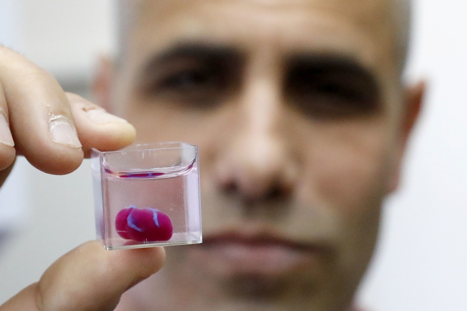 Israelische Forscher drucken erstmals Mini-Herz aus menschlichem Gewebe