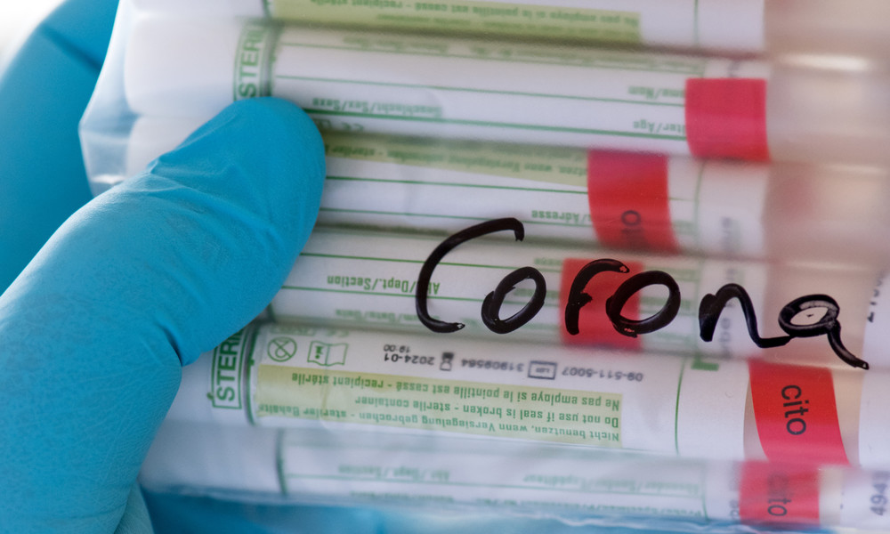 Corona-Ausschuss: "Es steht und fällt alles mit der Spezifität dieser Tests"
