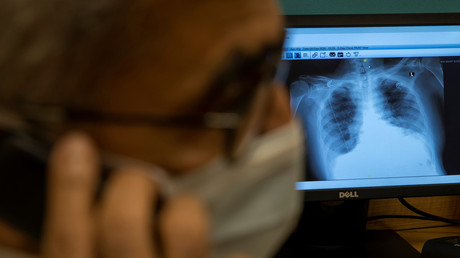 WHO-Studie: Vier bekannte Medikamente haben kaum Auswirkung auf COVID-19-Sterblichkeit