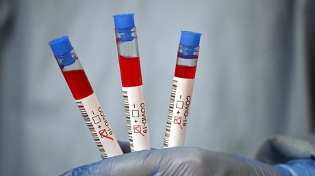 Berliner Senatsverwaltung nährt Zweifel an Aussagekraft der PCR-Tests