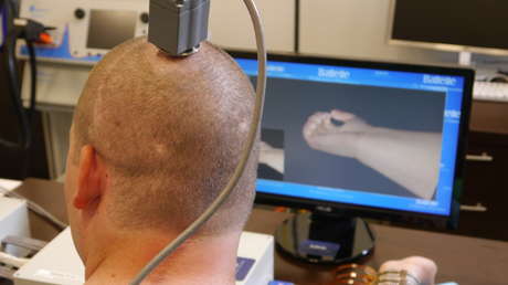 Chip im Gehirn? Russische Behörde dementiert Berichte über Implantat-Projekt