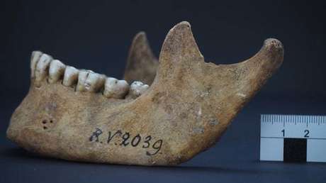 Pandemie schon vor 5.000 Jahren? – Archäologen finden Pest-Bakterien in Steinzeitmenschen