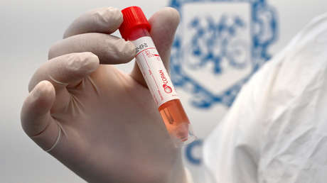 PCR-Test: In Deutschland teuer als "Goldstandard" verkauft – in den USA kurz vor der Abschaffung