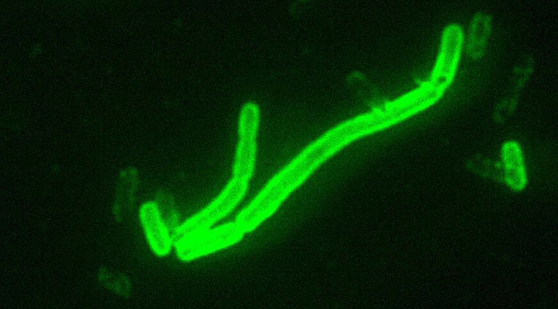 Teenage girl diagnosed with bubonic plague in Oregon