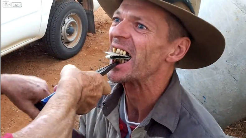 Flamin’ hell! Outback ‘dentist’ pulls teeth old-fashioned way