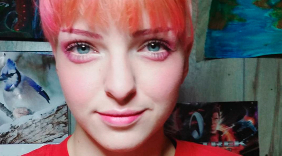 Hangover eyes: Odd make-up & injection craze form bizarre trend