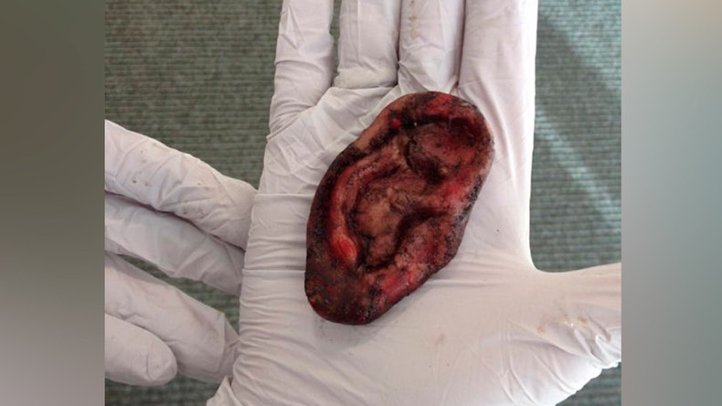 ‘Nothing to see ear’: UK Police called over fake severed ‘human’ lobe