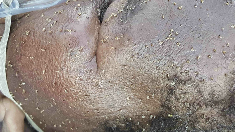 South African granny stung by 'thousands' of angry bees