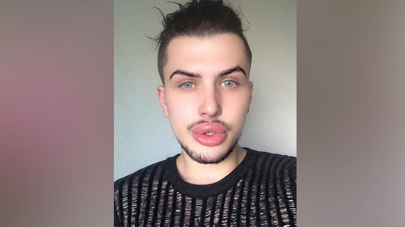 Kardashian-obsessed man spends £20k on cosmetic surgery to look like celebrity idols