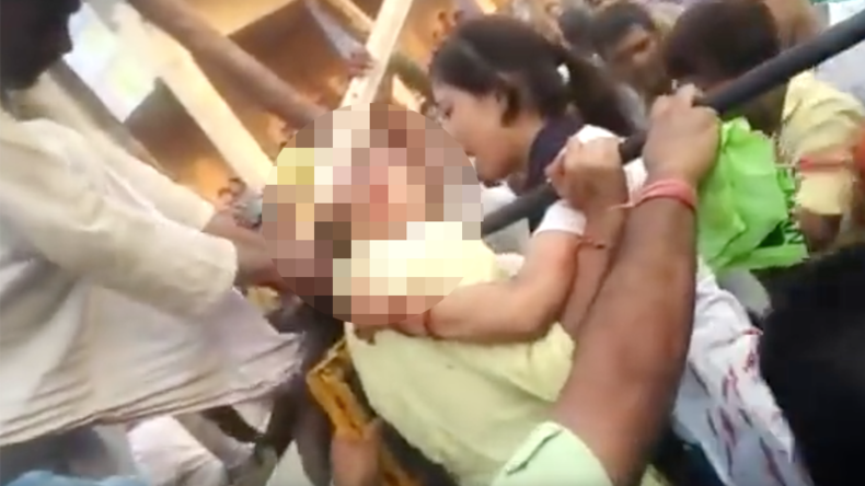 Teen’s hair ripped clean off head in bloodcurdling ferris wheel selfie bid (GRAPHIC VIDEO)