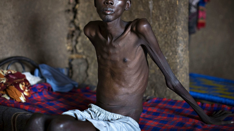 Global efforts to curb tuberculosis epidemic ‘fall far short’ – WHO
