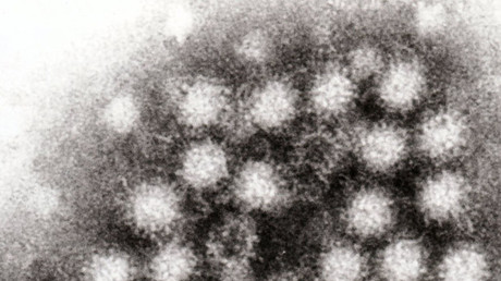 Transmission electron micrograph of norovirus particles in feces. © Graham Beards