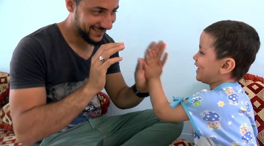 4-yo survivor of US-led coalition airstrike still has shrapnel in her legs & face (VIDEO)