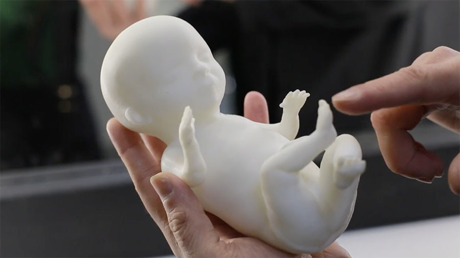 Expectant mothers can now get a 3D model of their unborn baby (VIDEO)