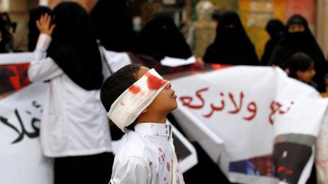 A boy wears a blindfold stained with fake blood as he takes part in an anti-Saudi protest in Sanaa, Yemen November 27, 2016 © Mohamed al-Sayaghi