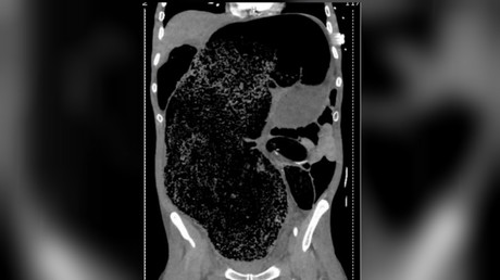 Bellingcat & Atlantic Council join to award exploited Syrian child & American mass murderer