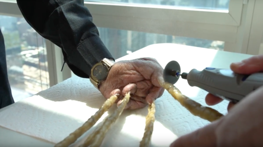 Indian Man With World S Longest Fingernails Has Them Clipped Put On Display In New York Video Rt World News