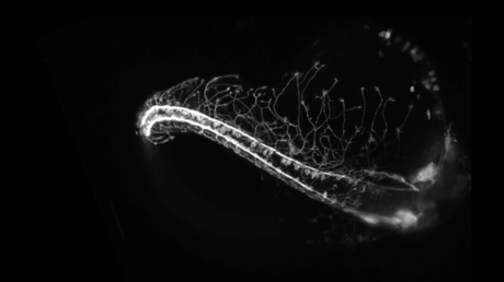 Nervous system captured growing in incredible timelapse footage (VIDEO)