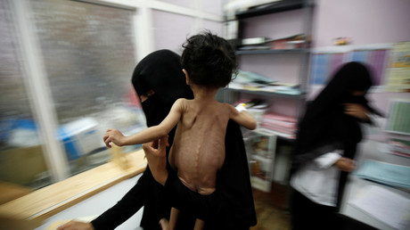 FILE PHOTO A woman is holding an emaciated child in hospital in Sanaa, Yemen. September 2016. © Khaled Abdullah / Reuters
