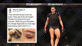 UFC fighter Zingano reveals gruesome toe-poke eye injury that led to TKO defeat (PHOTOS)