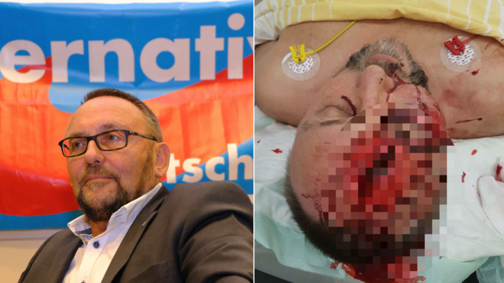 German AfD MP brutally beaten in ‘politically-motivated attempted assassination’ (GRAPHIC) German AfD MP brutally beaten in ‘politically-motivated attempted assassination’ (GRAPHIC)