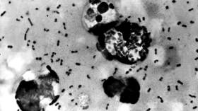 Bubonic plague found in Wyoming cat, 3rd such infection in 6 months